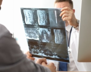 doctor hold xray bone spine radiography in hand. examination and treatment of intervertebral hernia. traumatology tomography hospital radiographer con 1