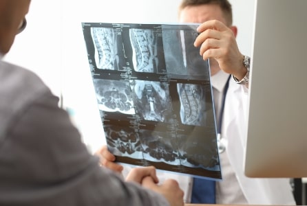 doctor hold xray bone spine radiography in hand. examination and treatment of intervertebral hernia. traumatology tomography hospital radiographer con